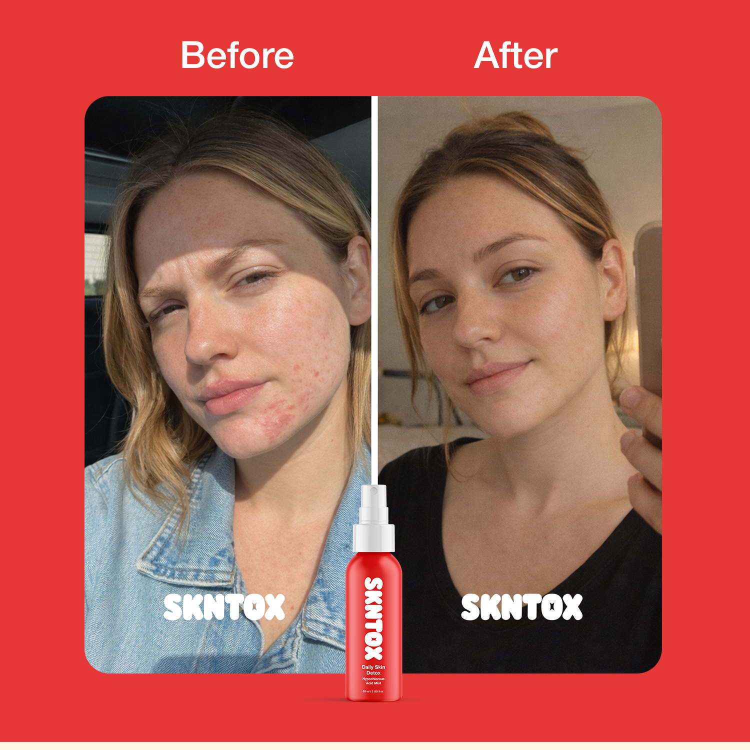 Daily Skin Detox Hypochlorous Acid Mist