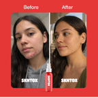 Daily Skin Detox Hypochlorous Acid Mist