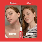 Daily Skin Detox Hypochlorous Acid Mist
