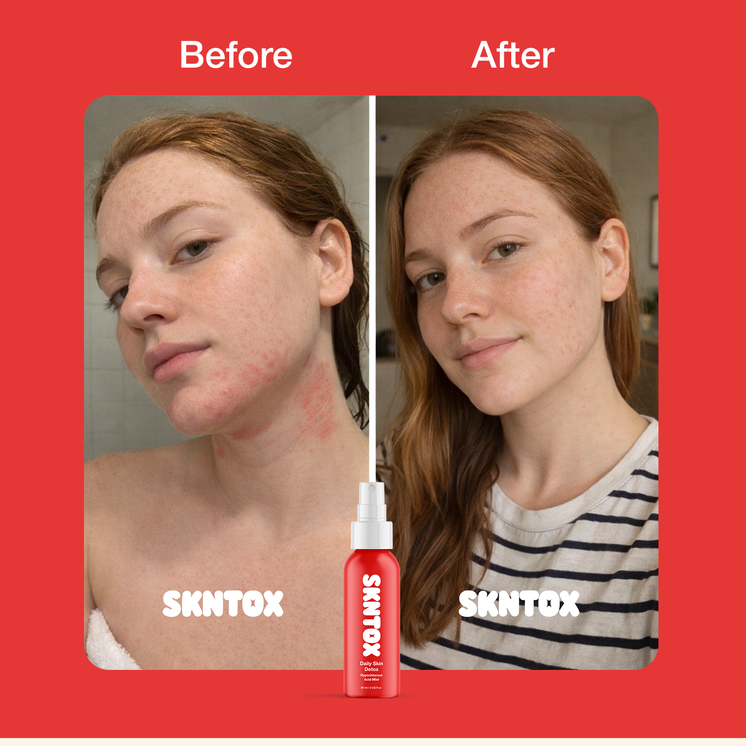 Daily Skin Detox Hypochlorous Acid Mist