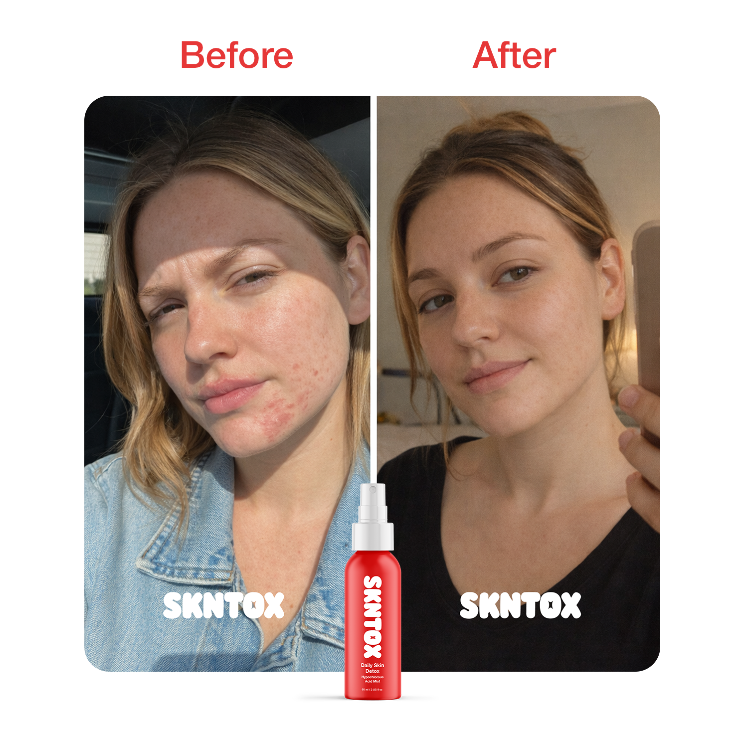 Before and After