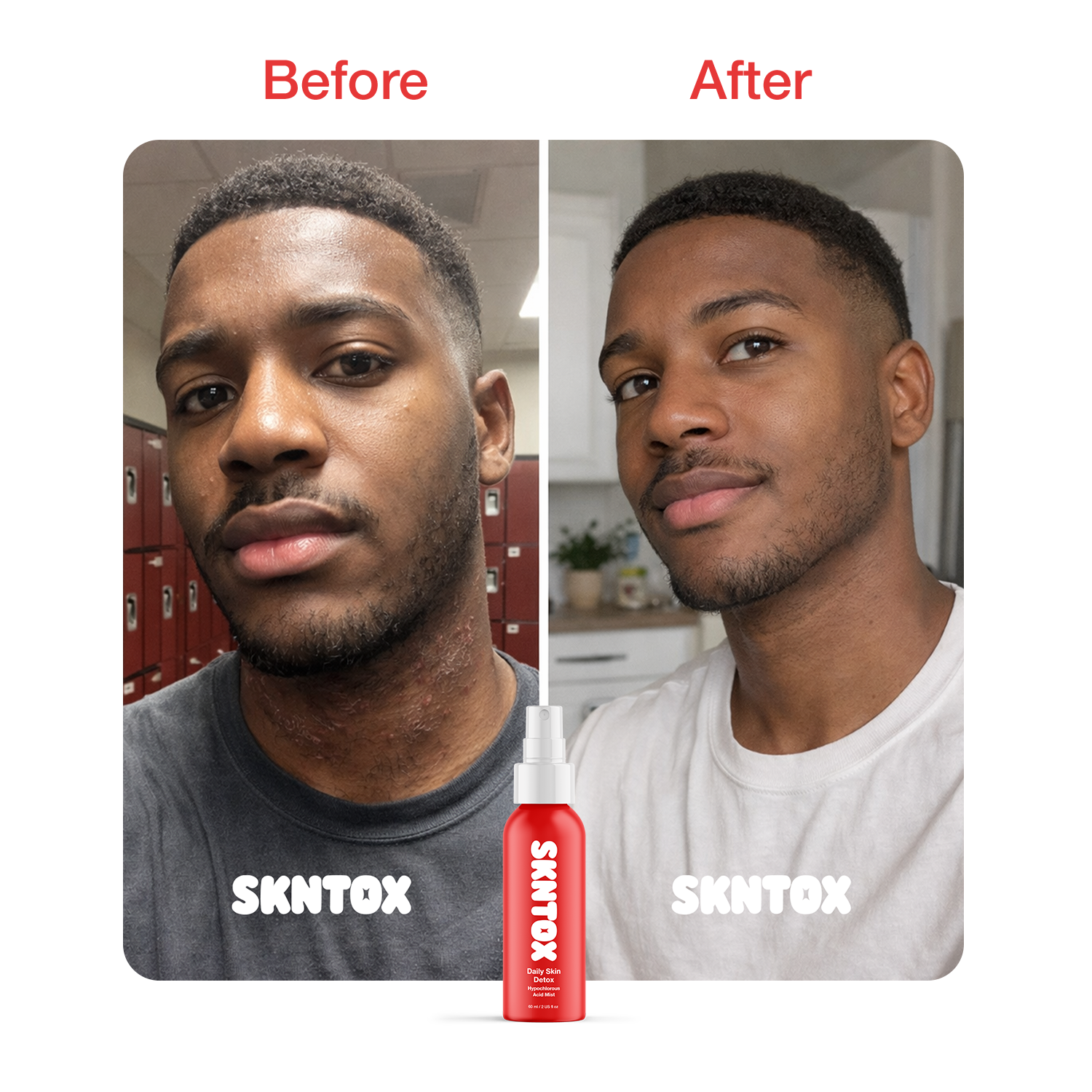 Before and After