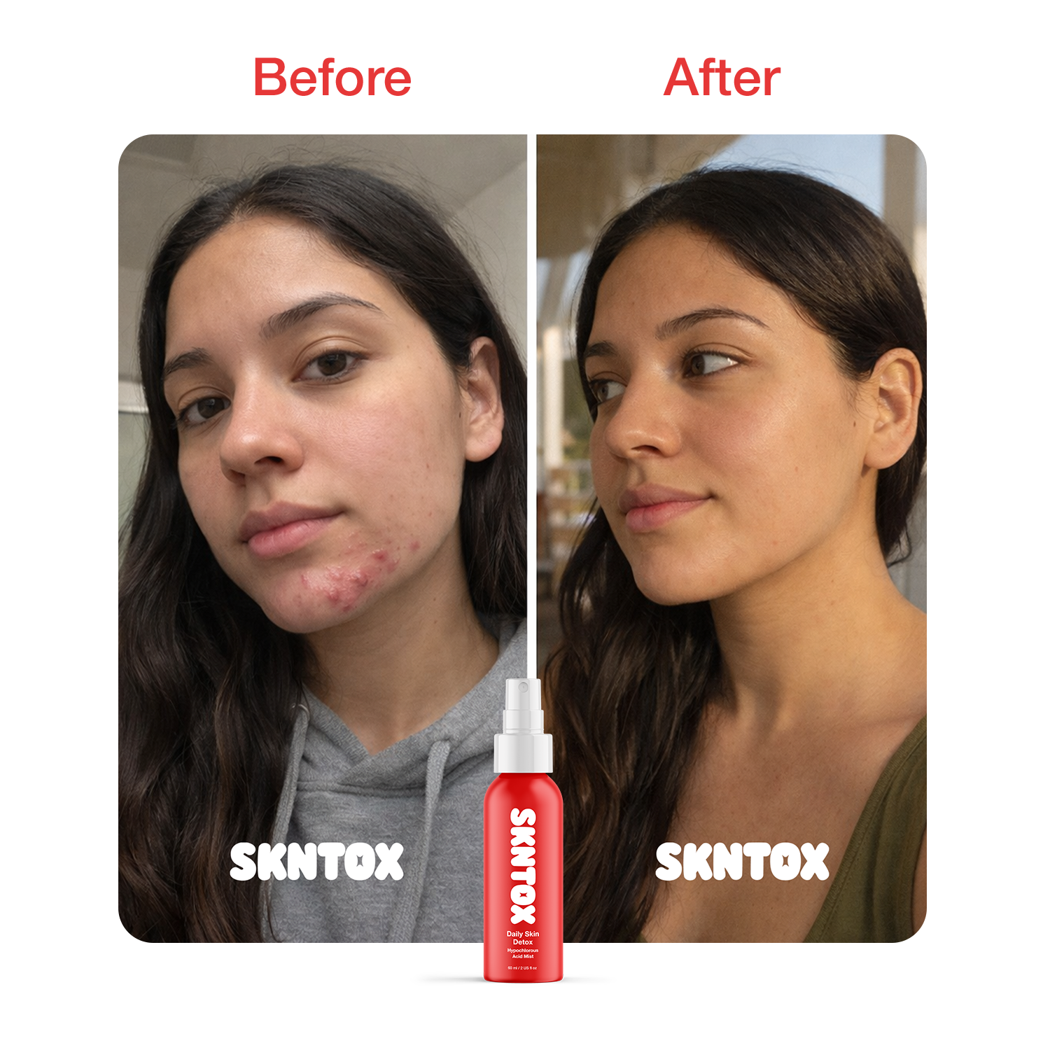 Before and After