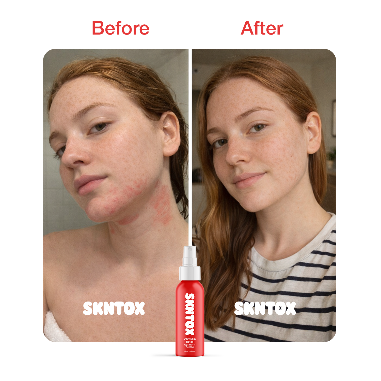 Before and After